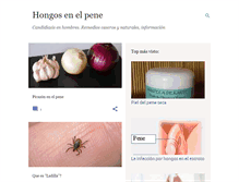 Tablet Screenshot of hongosenelpene.com